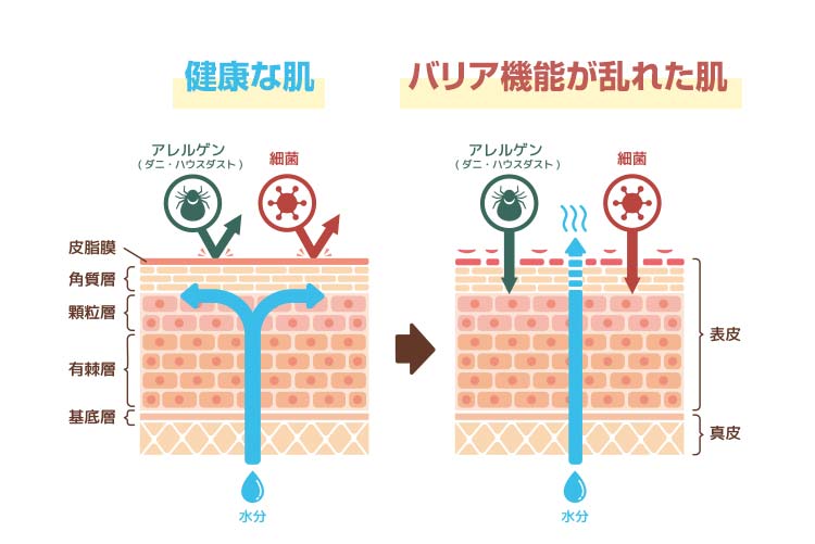 肌のバリア機能