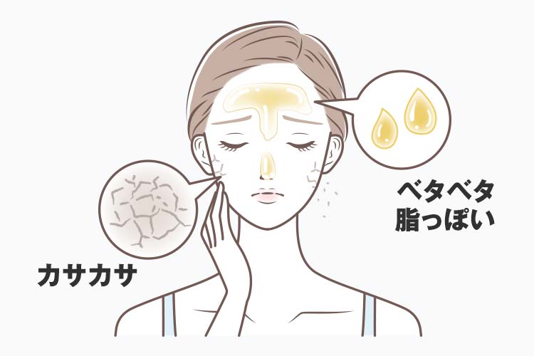 混合肌のTゾーンとUゾーンの肌質の違いを説明。