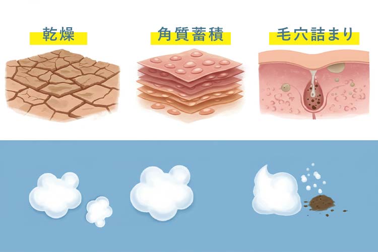 乾燥、角質蓄積、毛穴詰まりが肌のざらつきの原因