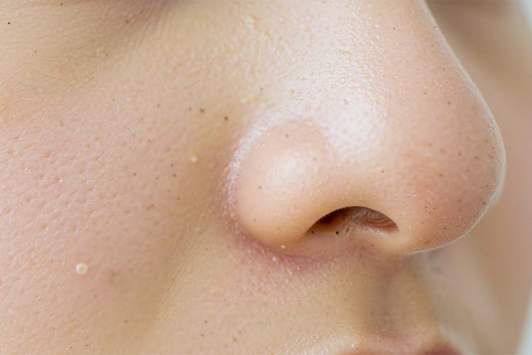 鼻の毛穴の構造と黒ずみの原因を解説 - 皮脂や汚れ、古い角質が詰まり、酸化することで黒ずみとなる