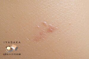 毛穴の黒ずみ・ニキビをケアする洗顔料の効果をイメージしたクローズアップ写真