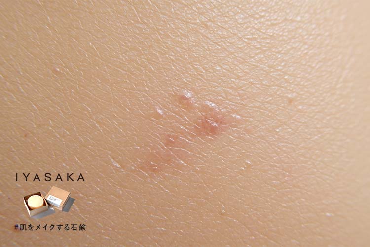 毛穴の黒ずみ・ニキビをケアする洗顔料の効果をイメージしたクローズアップ写真