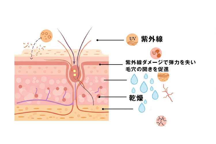 毛穴の仕組みと外部要因の影響を解説したイラスト