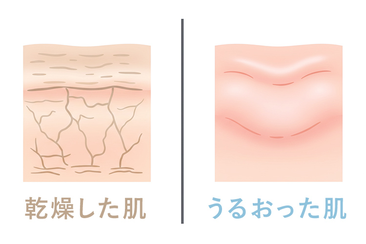 乾燥肌と潤い肌の比較。