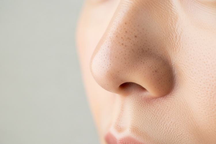 女性の顔の毛穴汚れを撮影した写真。